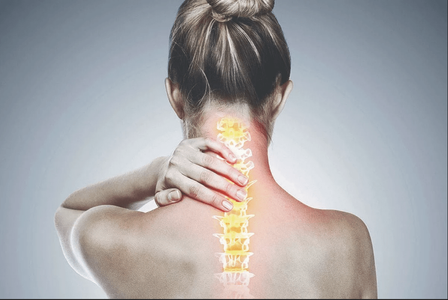 cervikálna osteochondróza